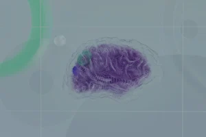 Representación de la Inteligencia Artificial en el derecho con un cerebro robótico